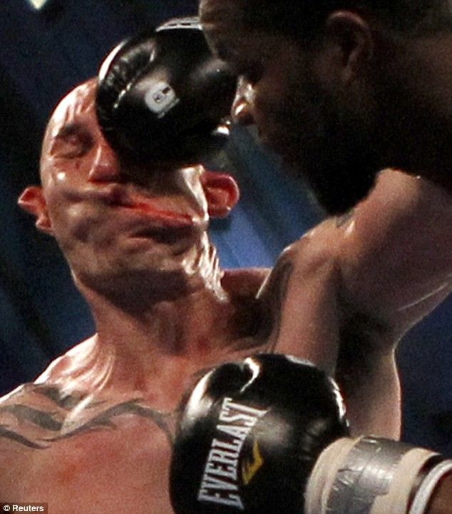 Lavarn Harvell Knockout Punch Smashes Tony Pietrantonios Face In Temporarily PHOTOS