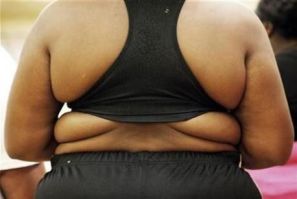 Obese Individuals at Health Risk