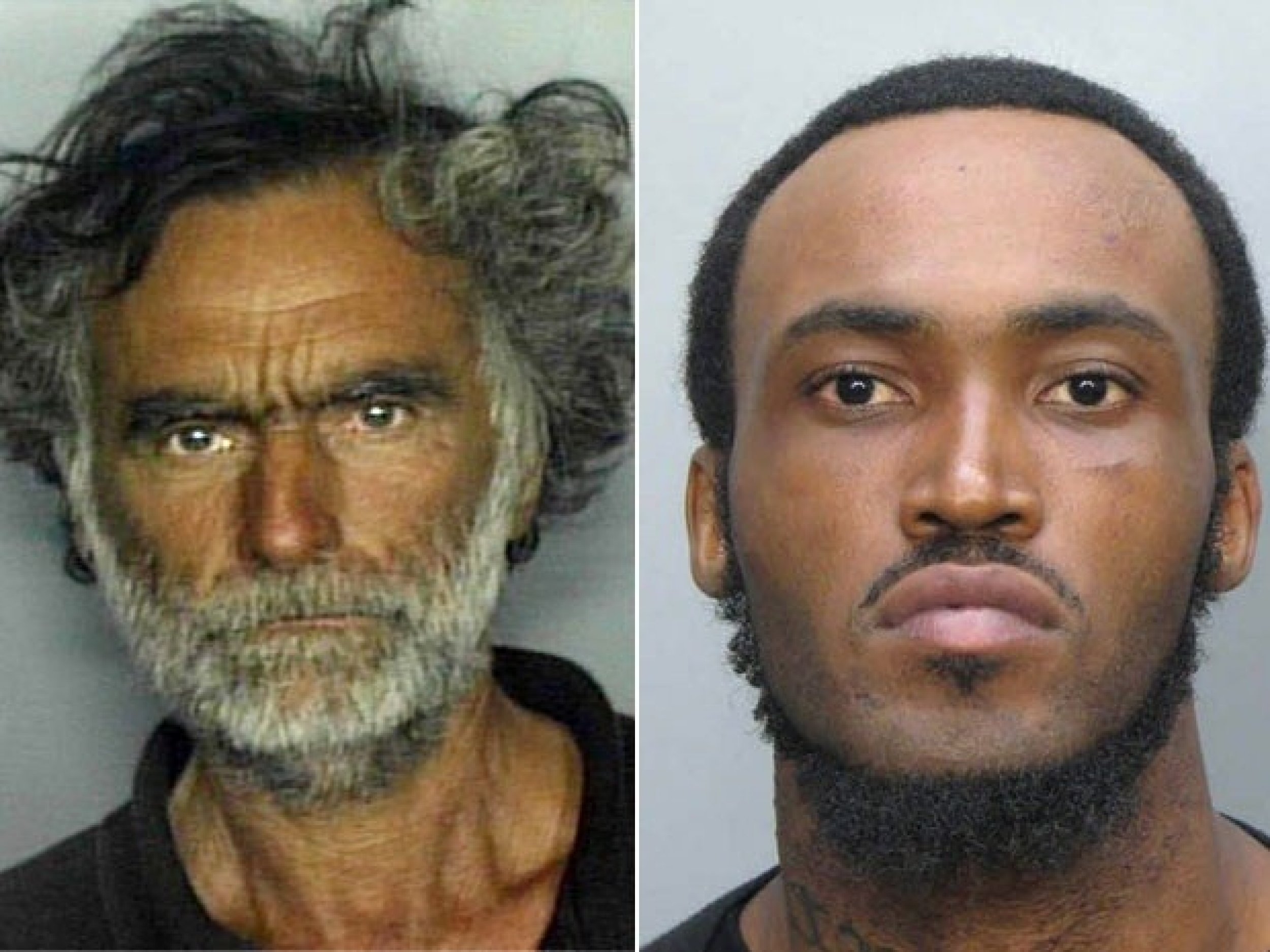 Miami Cannibal Attack Victim, Ronald Poppo, Faces Long Surgery Process