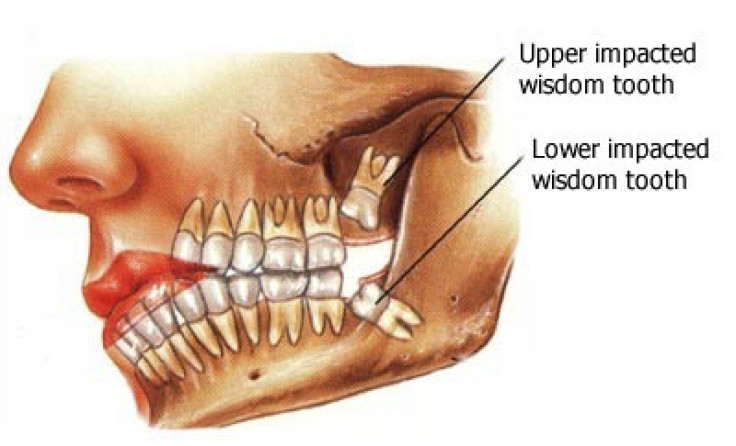 State of the Nation’s Teeth: $10B Needed to Fix Dental Health System - Report