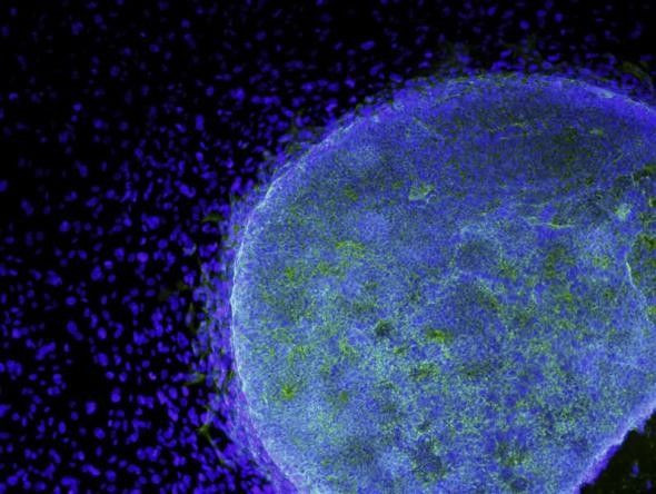 The vision of two legally blind women improved after receiving treatment using embryonic stem cells