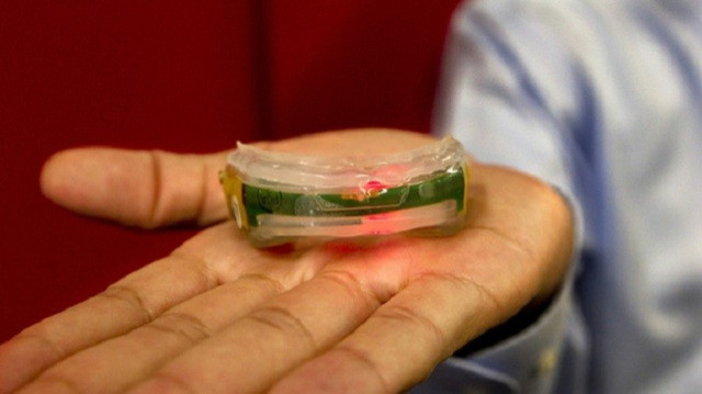 X2Impact mouthpieces gather data on head injuries