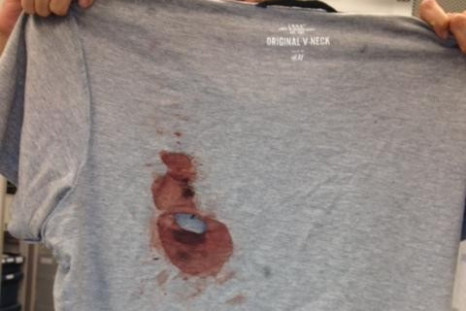 Reddit user &quot;the murderator&quot;'s bloody shirt.
