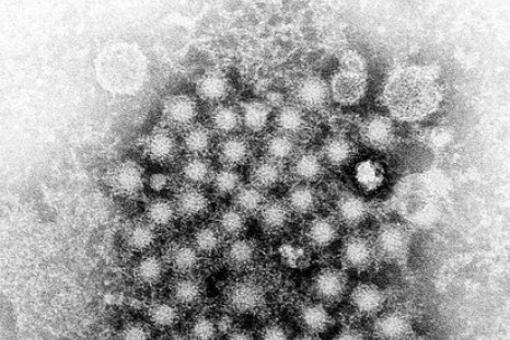 A file picture of a Hepatitis virus