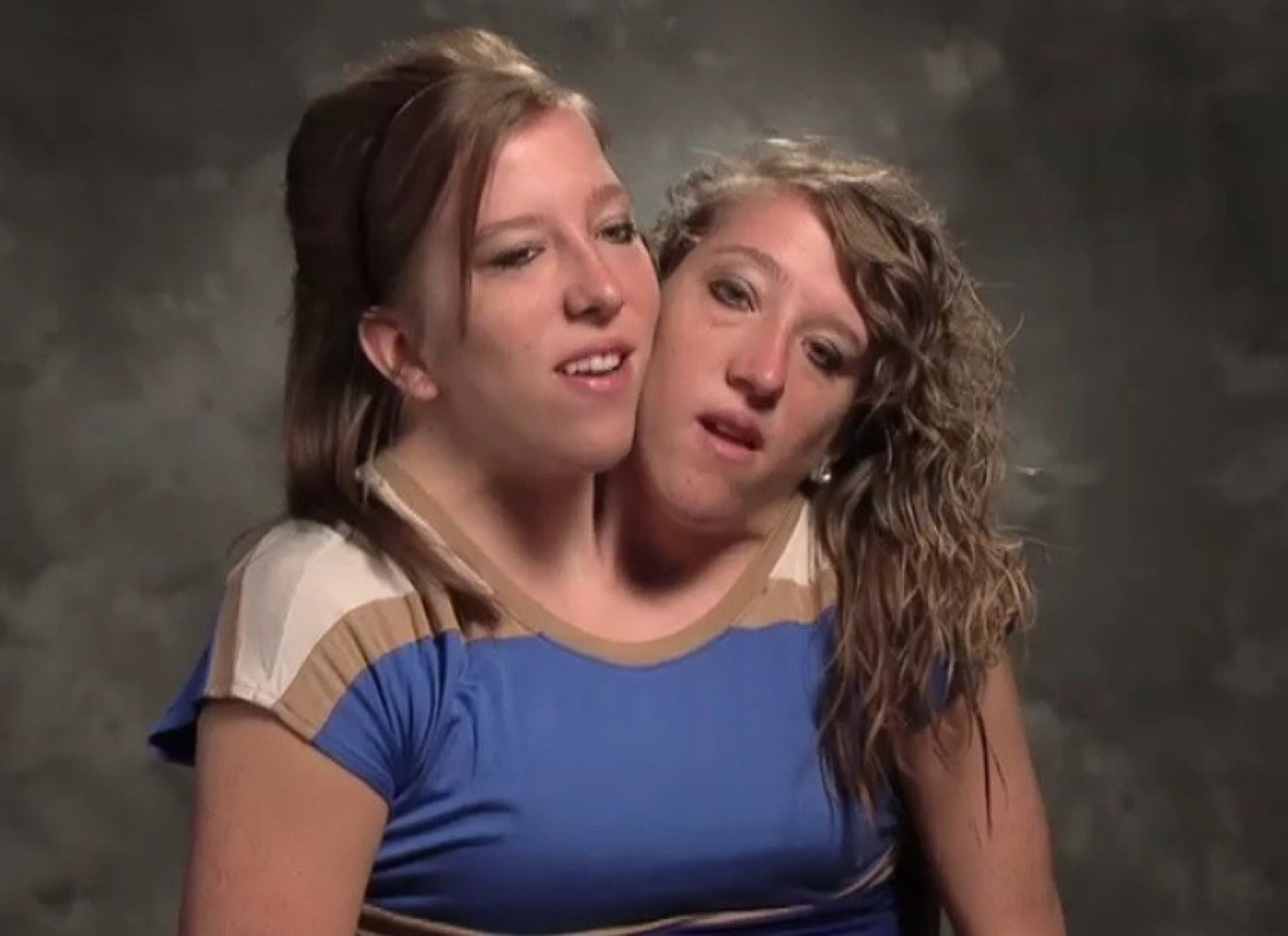 Conjoined Twins Abby and Brittany Hensel Star In New TLC Show; 'Abby