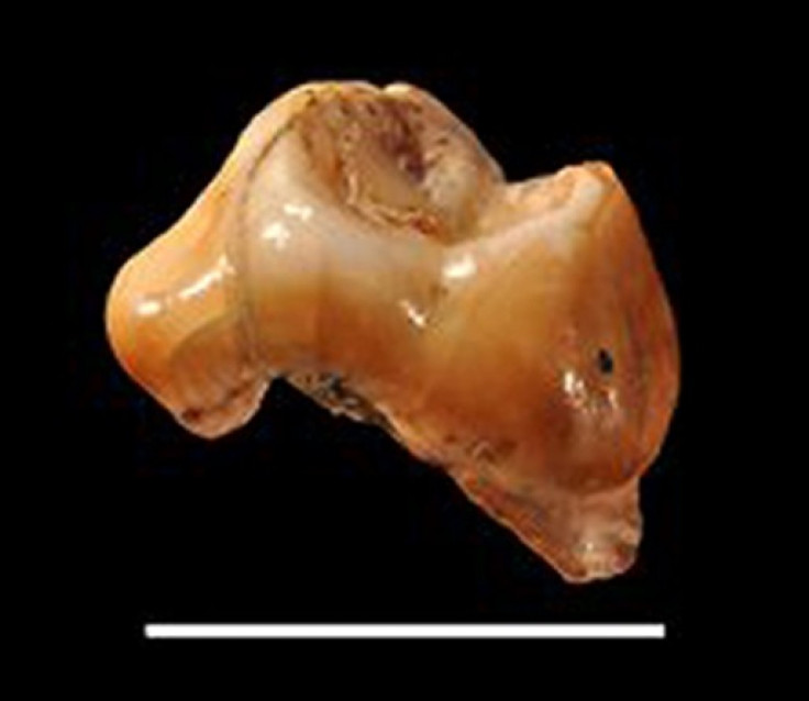 Human Tooth Fossil