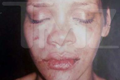 Rihanna attack