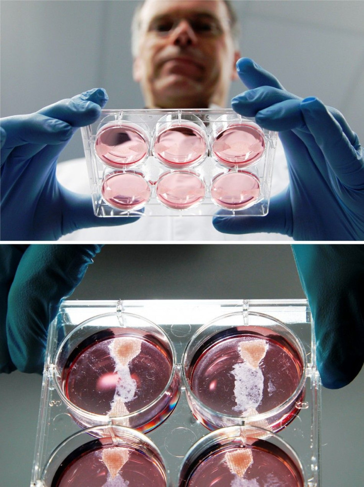 Scientist Mark Post displays samples of in-vitro meat, or cultured meat grown in a laboratory, at the University of Maastricht November 9, 2011.