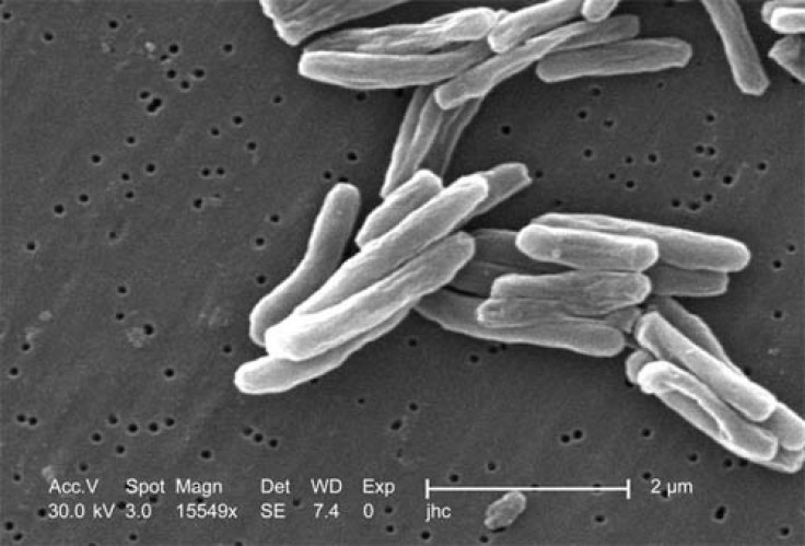 Tuberculosis Reaches Lowest Levels Since 1953 In U.S.