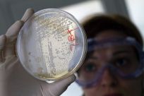 A laboratory worker looks for strains of E.coli bacteria in vegetable cells placed in a petri dish, in La Mojonera.