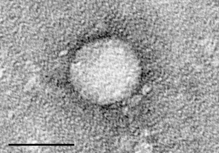 Electron micrographs of hepatitis C virus purified from cell culture. Scale bar is 50 nanometers. Courtesy of the Center for the Study of Hepatitis C, The Rockefeller University.