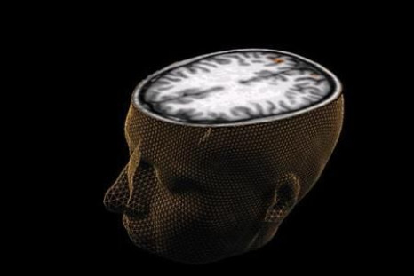An undated image of the human brain taken through scanning technology