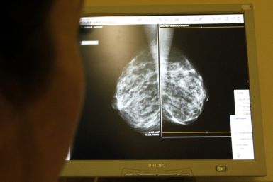 A woman undergoes a mammograms, a special type of X-ray of the breasts, which is used to detect tumours as part of a regular cancer prevention medical check-up at a clinic in Nice