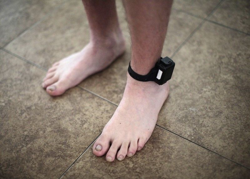 A probationer wears an ankle tracking device in Santa Ana, California