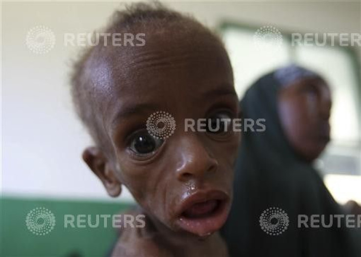 A malnourished Somali child looks into the camera inside a paediatric ward at the Banadir hospital in capital Mogadishu