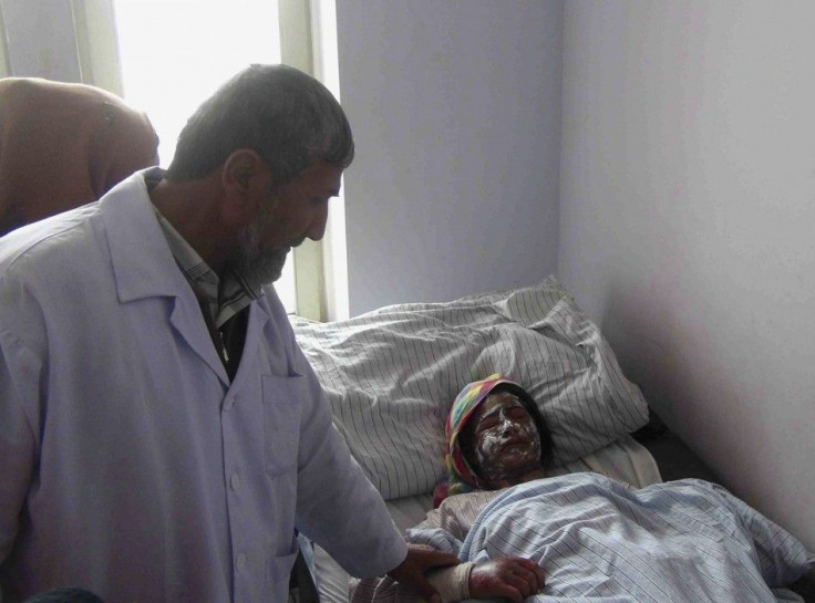 An Afghan woman receives treatment at a hospital after her family was attacked with acid at her home by unknown gunmen in Kunduz