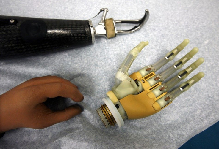 bionic hand