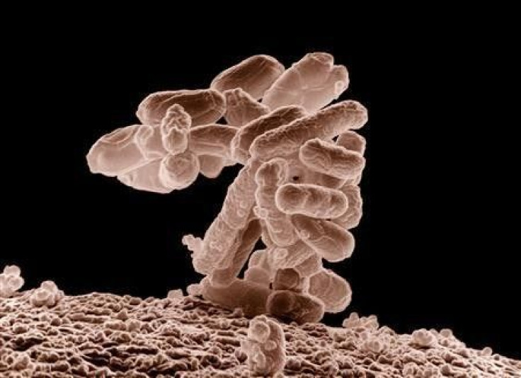 E. coli bacteria.