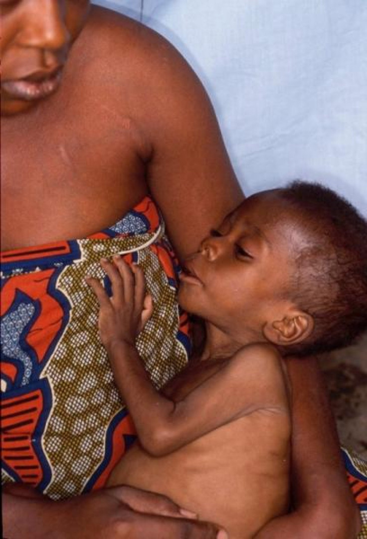 HIV-infected baby in Nigeria