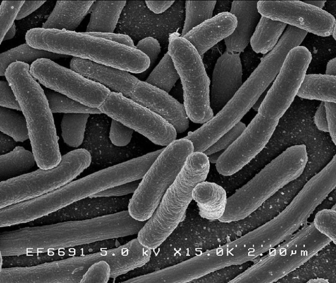 E Coli