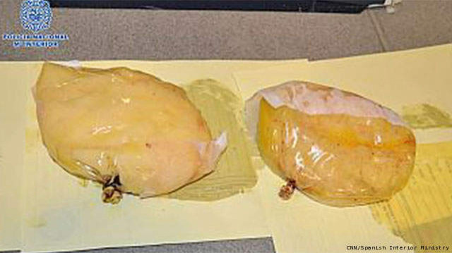 cocaine-implants