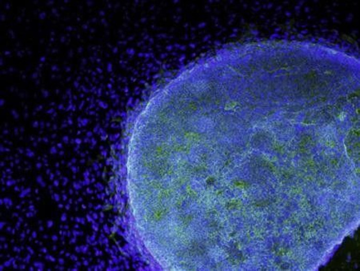 A microscopic view shows a colony of human embryonic stem cells (light blue) growing on fibroblasts (dark blue) in this handout photo released to Reuters by the California Institute for Regenerative Medicine, March 9, 2009.